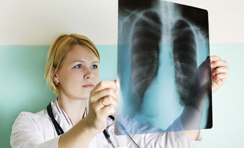 Bệnh lao phổi: nguyên nhân, triệu chứng và cách điều trị